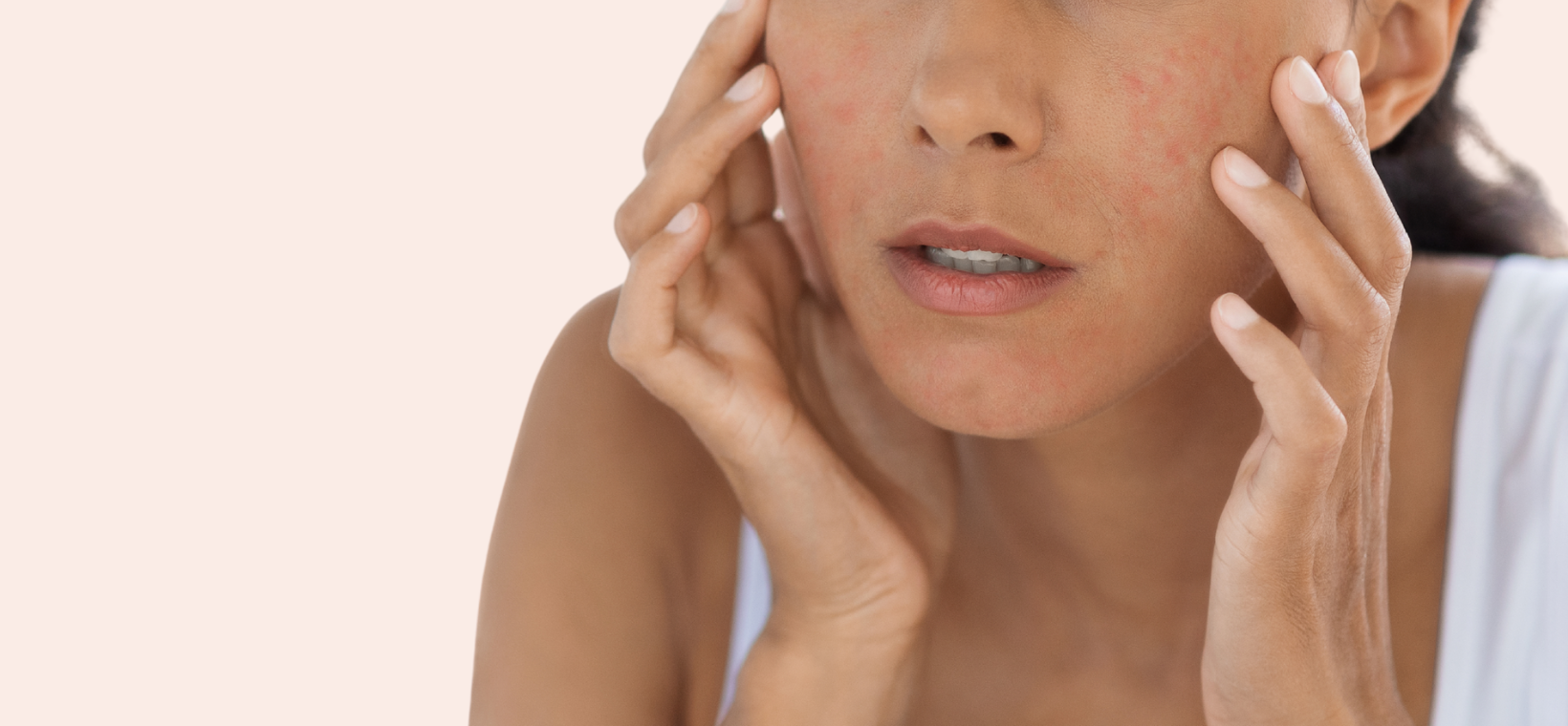 Visuel d'une femme s'appliquant du sérum apaisant bio Cattier sur le visage